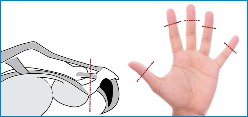 Comparaison de l'amputation de la 3e phalange du chat avec une main humaine. 